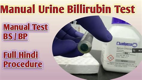 bilirubina 1 in urina|Bilirubin in Urine: MedlinePlus Medical Test